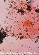 Gardnerella vaginalis under the microscope
