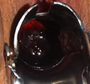 Cuello uterino sano
