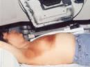 Radioterapia post-operatoria
