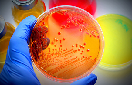 Cultivo de E. coli en placa de Petri